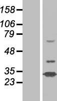 N4BP2L1 Protein - Western validation with an anti-DDK antibody * L: Control HEK293 lysate R: Over-expression lysate