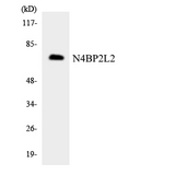 N4BP2L2 Antibody - Western blot analysis of the lysates from K562 cells using N4BP2L2 antibody.