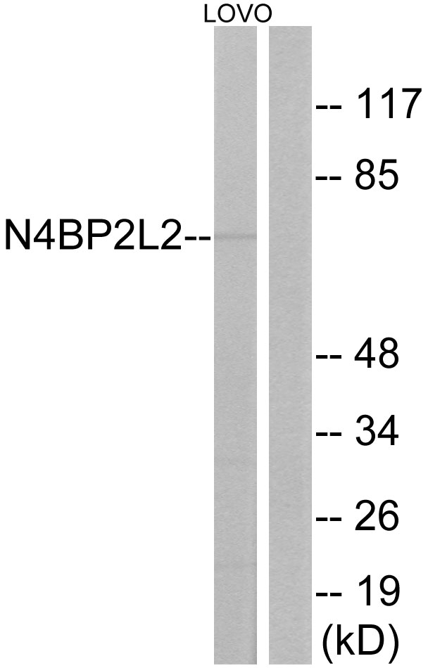 N4BP2L2 Antibody - Western blot analysis of lysates from LOVO cells, using N4BP2L2 Antibody. The lane on the right is blocked with the synthesized peptide.