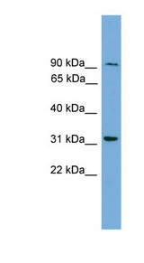 N4BP2L2 Antibody - N4BP2L2 antibody Western blot of OVCAR-3 cell lysate. This image was taken for the unconjugated form of this product. Other forms have not been tested.