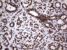 N4BP2L2 Antibody - Immunohistochemical staining of paraffin-embedded Human breast tissue within the normal limits using anti-N4BP2L2 mouse monoclonal antibody. (Heat-induced epitope retrieval by 1 mM EDTA in 10mM Tris, pH8.5, 120C for 3min,