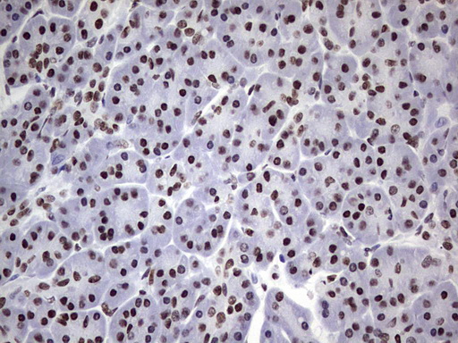 N4BP2L2 Antibody - Immunohistochemical staining of paraffin-embedded Human pancreas tissue within the normal limits using anti-N4BP2L2 mouse monoclonal antibody. (Heat-induced epitope retrieval by 1 mM EDTA in 10mM Tris, pH8.5, 120C for 3min,