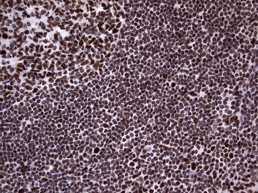 N4BP2L2 Antibody - Immunohistochemical staining of paraffin-embedded Human tonsil within the normal limits using anti-N4BP2L2 mouse monoclonal antibody. (Heat-induced epitope retrieval by 1 mM EDTA in 10mM Tris, pH8.5, 120C for 3min,