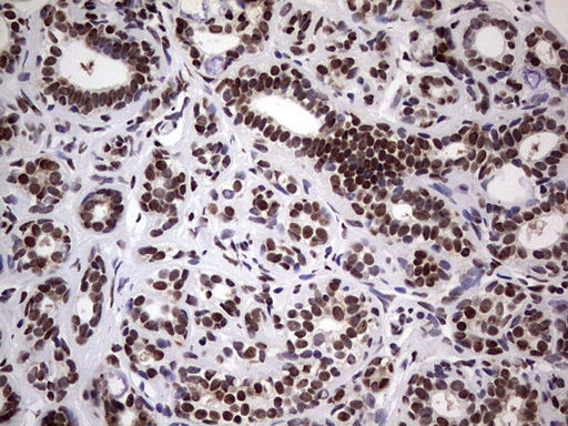 N4BP2L2 Antibody - IHC of paraffin-embedded Human breast tissue using anti-N4BP2L2 mouse monoclonal antibody. (Heat-induced epitope retrieval by 1 mM EDTA in 10mM Tris, pH8.5, 120°C for 3min).
