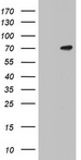 N4BP2L2 Antibody - HEK293T cells were transfected with the pCMV6-ENTRY control (Left lane) or pCMV6-ENTRY N4BP2L2 (Right lane) cDNA for 48 hrs and lysed. Equivalent amounts of cell lysates (5 ug per lane) were separated by SDS-PAGE and immunoblotted with anti-N4BP2L2.