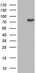 N4BP2L2 Antibody - HEK293T cells were transfected with the pCMV6-ENTRY control. (Left lane) or pCMV6-ENTRY N4BP2L2. (Right lane) cDNA for 48 hrs and lysed. Equivalent amounts of cell lysates. (5 ug per lane) were separated by SDS-PAGE and immunoblotted with anti-N4BP2L2.