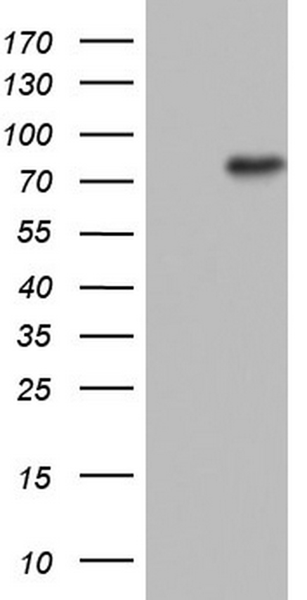 N4BP2L2 Antibody - HEK293T cells were transfected with the pCMV6-ENTRY control (Left lane) or pCMV6-ENTRY N4BP2L2 (Right lane) cDNA for 48 hrs and lysed. Equivalent amounts of cell lysates (5 ug per lane) were separated by SDS-PAGE and immunoblotted with anti-N4BP2L2.