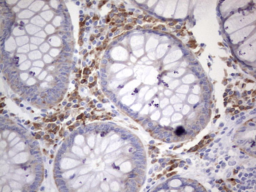 N4BP2L2 Antibody - Immunohistochemical staining of paraffin-embedded Human colon tissue within the normal limits using anti-N4BP2L2 mouse monoclonal antibody. (Heat-induced epitope retrieval by 1 mM EDTA in 10mM Tris, pH8.5, 120C for 3min,