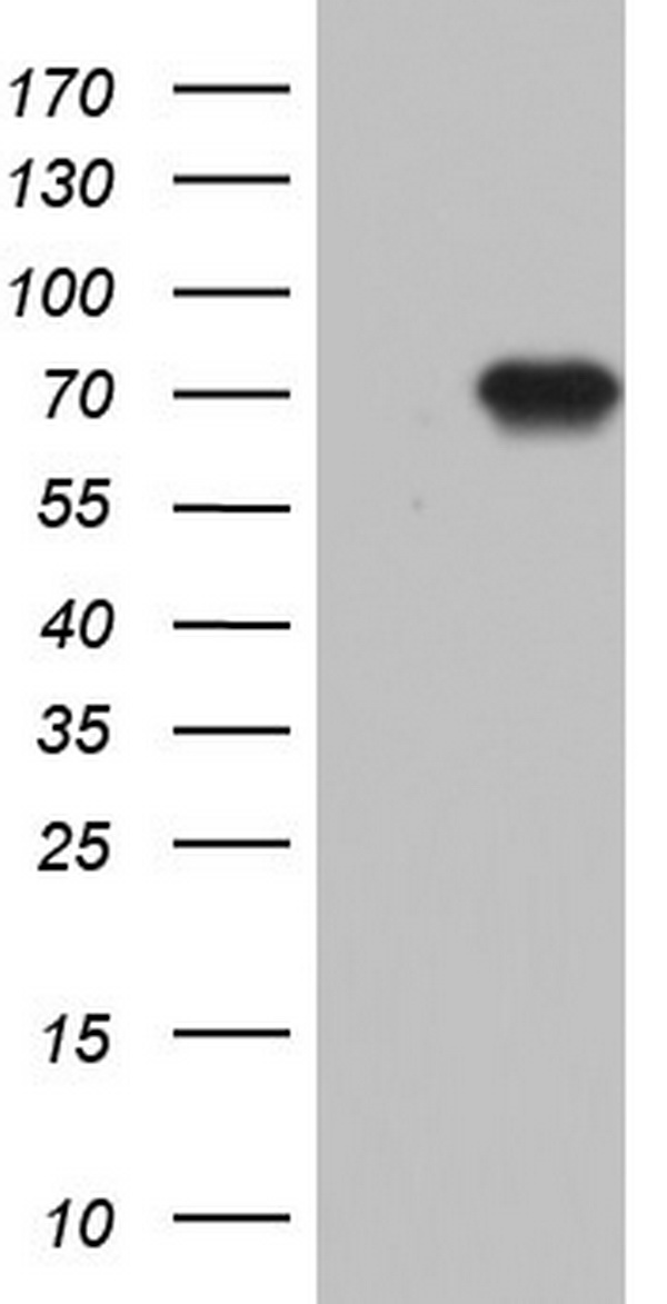 N4BP2L2 Antibody - HEK293T cells were transfected with the pCMV6-ENTRY control (Left lane) or pCMV6-ENTRY N4BP2L2 (Right lane) cDNA for 48 hrs and lysed. Equivalent amounts of cell lysates (5 ug per lane) were separated by SDS-PAGE and immunoblotted with anti-N4BP2L2.