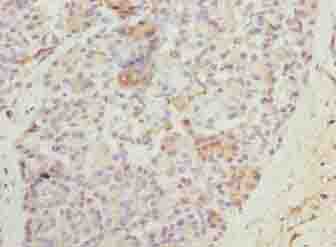 N4BP2L2 Antibody - Immunohistochemistry of paraffin-embedded human pancreatic tissue using antibody at dilution of 1:100.