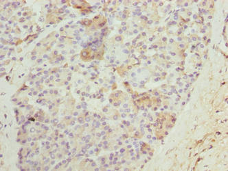 N4BP2L2 Antibody - Immunohistochemistry of paraffin-embedded human pancreatic tissue using N4BP2L2 Antibody at dilution of 1:100