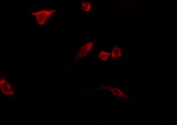 N4BP2L2 Antibody - Staining LOVO cells by IF/ICC. The samples were fixed with PFA and permeabilized in 0.1% Triton X-100, then blocked in 10% serum for 45 min at 25°C. The primary antibody was diluted at 1:200 and incubated with the sample for 1 hour at 37°C. An Alexa Fluor 594 conjugated goat anti-rabbit IgG (H+L) Ab, diluted at 1/600, was used as the secondary antibody.