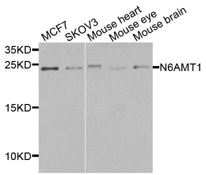 N6AMT1 Antibody - Western blot analysis of extracts of various cells.