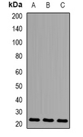 N6AMT1 Antibody - Western blot analysis of HEMK2 expression in SKOV3 (A); mouse heart (B); mouse brain (C) whole cell lysates.