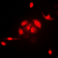 N6AMT1 Antibody - Immunofluorescent analysis of HEMK2 staining in A549 cells. Formalin-fixed cells were permeabilized with 0.1% Triton X-100 in TBS for 5-10 minutes and blocked with 3% BSA-PBS for 30 minutes at room temperature. Cells were probed with the primary antibody in 3% BSA-PBS and incubated overnight at 4 deg C in a humidified chamber. Cells were washed with PBST and incubated with a DyLight 594-conjugated secondary antibody (red) in PBS at room temperature in the dark.