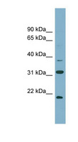 N6AMT1 Antibody - N6AMT1 antibody Western blot of NCI-H226 cell lysate. This image was taken for the unconjugated form of this product. Other forms have not been tested.