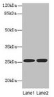 N6AMT2 Antibody - Western blot All lanes: N6AMT2 antibody at 10µg/ml Lane 1: Jurkat whole cell lysate Lane 2: K562 whole cell lysate Secondary Goat polyclonal to rabbit IgG at 1/10000 dilution Predicted band size: 24 kDa Observed band size: 24 kDa
