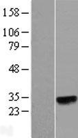 N6AMT2 Protein - Western validation with an anti-DDK antibody * L: Control HEK293 lysate R: Over-expression lysate
