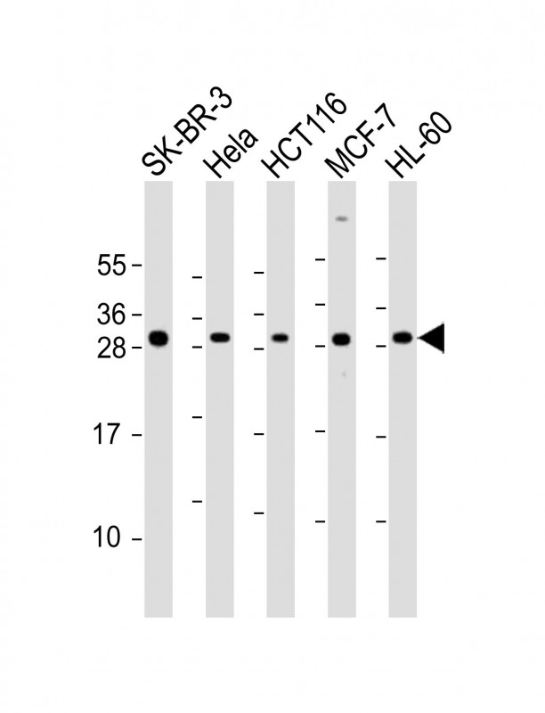 NAA10 / ARD1A Antibody - All lanes: Anti-NAA10 Antibody (Center) at 1:2000 dilution. Lane 1: SK-BR-3 whole cell lysate. Lane 2: HeLa whole cell lysate. Lane 3: HCT116 whole cell lysate. Lane 4: MCF-7 whole cell lysate. Lane 5: HL-60 whole cell lysate Lysates/proteins at 20 ug per lane. Secondary Goat Anti-Rabbit IgG, (H+L), Peroxidase conjugated at 1:10000 dilution. Predicted band size: 26 kDa. Blocking/Dilution buffer: 5% NFDM/TBST.