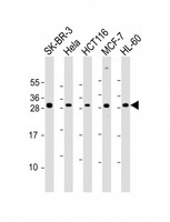 NAA10 / ARD1A Antibody - All lanes: Anti-NAA10 Antibody (Center) at 1:2000 dilution. Lane 1: SK-BR-3 whole cell lysate. Lane 2: HeLa whole cell lysate. Lane 3: HCT116 whole cell lysate. Lane 4: MCF-7 whole cell lysate. Lane 5: HL-60 whole cell lysate Lysates/proteins at 20 ug per lane. Secondary Goat Anti-Rabbit IgG, (H+L), Peroxidase conjugated at 1:10000 dilution. Predicted band size: 26 kDa. Blocking/Dilution buffer: 5% NFDM/TBST.