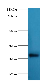 NAA10 / ARD1A Antibody - Western blot. All lanes: N-alpha-acetyltransferase 10 antibody at 5 ug/ml+HeLa whole cell lysate. Secondary antibody: Goat polyclonal to rabbit at 1:10000 dilution. Predicted band size: 26 kDa. Observed band size: 26 kDa Immunohistochemistry.