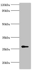 NAA10 / ARD1A Antibody - Western blot All lanes: N-alpha-acetyltransferase 10 antibody at 5µg/ml + Hela whole cell lysate Secondary Goat polyclonal to rabbit IgG at 1/10000 dilution Predicted band size: 27, 25 kDa Observed band size: 27 kDa