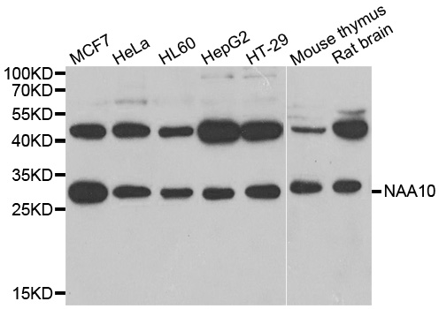 NAA10 / ARD1A Antibody - Western blot analysis of extracts of various cell lines.