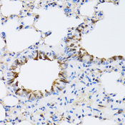 NAA10 / ARD1A Antibody - Immunohistochemistry of paraffin-embedded rat lung tissue.