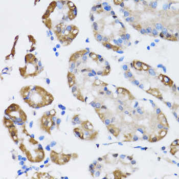NAA10 / ARD1A Antibody - Immunohistochemistry of paraffin-embedded human stomach tissue.