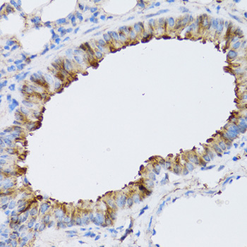 NAA10 / ARD1A Antibody - Immunohistochemistry of paraffin-embedded mouse lung tissue.