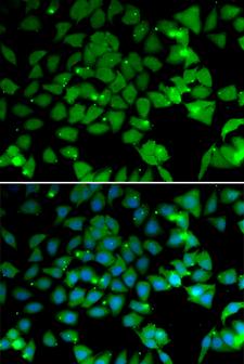NAA10 / ARD1A Antibody - Immunofluorescence analysis of U2OS cells.