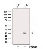 NAA10 / ARD1A Antibody - Western blot analysis of extracts of HeLa cells using ARD1A antibody. The lane on the left was treated with blocking peptide.