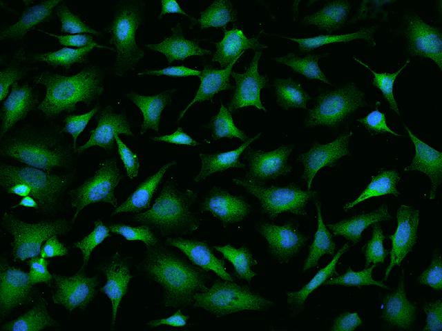 NAA10 / ARD1A Antibody - Immunofluorescence staining of NAA10 in HeLa cells. Cells were fixed with 4% PFA, permeabilzed with 0.1% Triton X-100 in PBS, blocked with 10% serum, and incubated with rabbit anti-Human NAA10 polyclonal antibody (dilution ratio 1:100) at 4°C overnight. Then cells were stained with the Alexa Fluor 488-conjugated Goat Anti-rabbit IgG secondary antibody (green) and counterstained with DAPI (blue). Positive staining was localized to Cytoplasm.