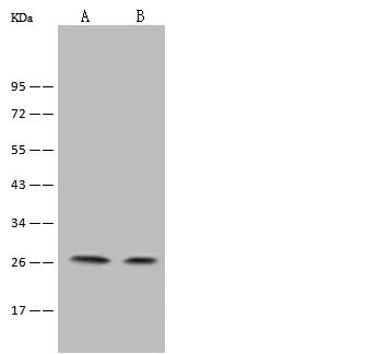 NAA10 / ARD1A Antibody - Anti-NAA10 rabbit polyclonal antibody at 1:500 dilution. Lane A: NIH-3T3 Whole Cell Lysate. Lane B: RAW264.7 Whole Cell Lysate. Lysates/proteins at 30 ug per lane. Secondary: Goat Anti-Rabbit IgG (H+L)/HRP at 1/10000 dilution. Developed using the ECL technique. Performed under reducing conditions. Predicted band size: 26 kDa. Observed band size: 27 kDa.