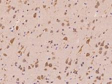 NAA10 / ARD1A Antibody - Immunochemical staining of human NAA10 in human brain with rabbit polyclonal antibody at 1:200 dilution, formalin-fixed paraffin embedded sections.