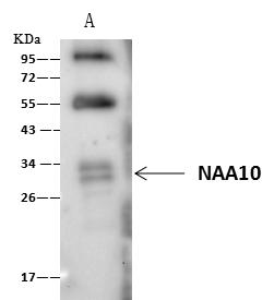 NAA10 / ARD1A Antibody - NAA10 was immunoprecipitated using: Lane A: 0.5 mg NIH 3T3 Whole Cell Lysate. 4 uL anti-NAA10 rabbit polyclonal antibody and 60 ug of Immunomagnetic beads Protein A/G. Primary antibody: Anti-NAA10 rabbit polyclonal antibody, at 1:100 dilution. Secondary antibody: Goat Anti-Rabbit IgG (H+L)/HRP at 1/10000 dilution. Developed using the ECL technique. Performed under reducing conditions. Predicted band size: 26 kDa. Observed band size: 28 kDa.