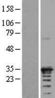 NAA10 / ARD1A Protein - Western validation with an anti-DDK antibody * L: Control HEK293 lysate R: Over-expression lysate