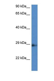 NAA11 / ARD1B Antibody - Naa11 / Ard1b antibody Western blot of Rat Lung lysate. Antibody concentration 1 ug/ml.  This image was taken for the unconjugated form of this product. Other forms have not been tested.