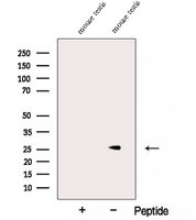 NAA11 / ARD1B Antibody - Western blot analysis of extracts of mouse testis tissue using ARD1B antibody. The lane on the left was treated with blocking peptide.