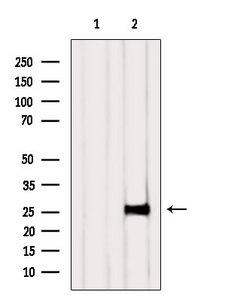 NAA11 / ARD1B Antibody