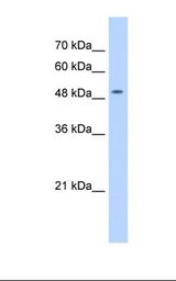 NAA16 / NARG1L Antibody - HepG2 cell lysate. Antibody concentration: 0.5 ug/ml. Gel concentration: 12%.  This image was taken for the unconjugated form of this product. Other forms have not been tested.