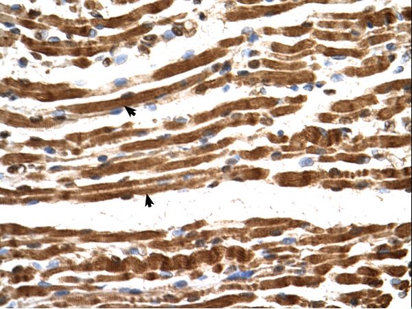 NAA16 / NARG1L Antibody - NAA16 / NARG1L antibody NARG1L(NMDA receptor regulated 1-like) Antibody was used in IHC to stain formalin-fixed, paraffin-embedded human muscle.  This image was taken for the unconjugated form of this product. Other forms have not been tested.