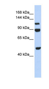 NAA16 / NARG1L Antibody - NAA16 / NARG1L antibody Western blot of 293T cell lysate. This image was taken for the unconjugated form of this product. Other forms have not been tested.
