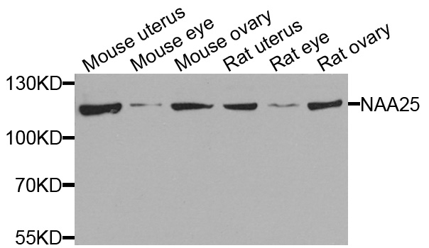 NAA25 Antibody - Western blot analysis of extracts of various cells.