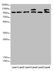 NAA25 Antibody - Western blot All Lanes: NAA25 antibody at 2.12 ug/ml Lane 1: Mouse liver tissue Lane 2: Mouse kidney tissue Lane 3: Hela whole cell lysate Lane 4: 293T whole cell lysate Lane 5: A549 whole cell lysate Lane 6: HepG-2 whole cell lysate Secondary Goat polyclonal to rabbit IgG at 1/10000 dilution Predicted band size: 113,100 kDa Observed band size: 112,120 kDa
