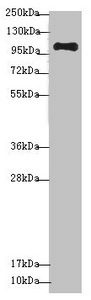 NAA25 Antibody - Western blot All Lanes: NAA25 antibody at 1.36 ug/ml+ Mouse kidney tissue Secondary Goat polyclonal to rabbit IgG at 1/10000 dilution Predicted band size: 113,100 kDa Observed band size: 112 kDa