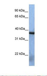 NAA30 Antibody - Fetal heart lysate. Antibody concentration: 1.0 ug/ml. Gel concentration: 12%.  This image was taken for the unconjugated form of this product. Other forms have not been tested.