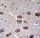 NAA30 Antibody - NAT12 Antibody immunohistochemistry of formalin-fixed and paraffin-embedded human brain tissue followed by peroxidase-conjugated secondary antibody and DAB staining.