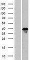 NAA30 Protein - Western validation with an anti-DDK antibody * L: Control HEK293 lysate R: Over-expression lysate
