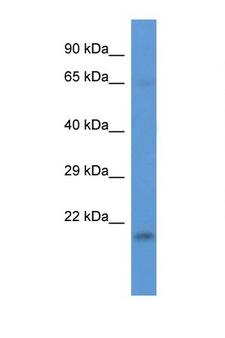 NAA38 / LSMD1 Antibody - LSMD1 antibody Western blot of 721_B Cell lysate. Antibody concentration 1 ug/ml.  This image was taken for the unconjugated form of this product. Other forms have not been tested.
